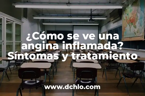 ¿Con qué se cura el dengue? - Tratamientos y Remedio Naturales 4 ¿Cómo se ve una angina inflamada? Síntomas y tratamiento