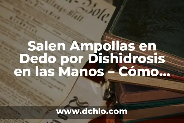 ¿Por qué me salen ronchas en el cuerpo y luego desaparecen? 8 Salen Ampollas en Dedo por Dishidrosis en las Manos – Cómo Tratar este Problema