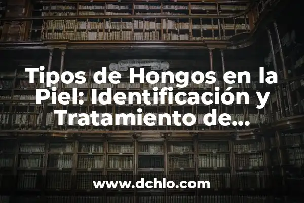 La Identificación de las Amenazas Significativas: Guía Completa 4 Tipos de Hongos en la Piel: Identificación y Tratamiento de Infecciones Fúngicas Cutáneas