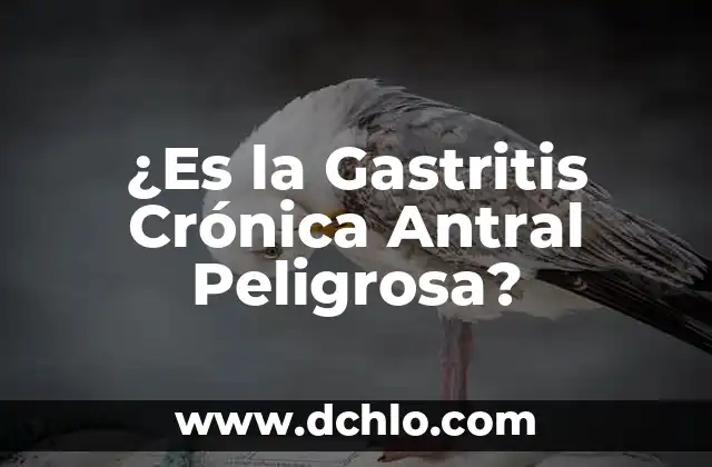 Diferencias entre la Masa y el Peso: ¿Cuál es la Distinción Correcta? 7 ¿Es la Gastritis Crónica Antral Peligrosa?