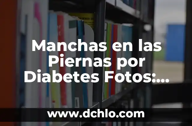 Dolor en la parte baja izquierda del abdomen: Causas y Soluciones 7 Manchas en las Piernas por Diabetes Fotos: Causas, Síntomas y Tratamiento