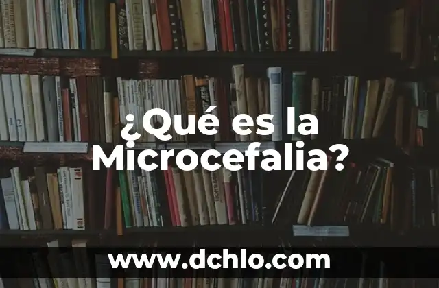 ¿Qué es el Paquete Office de Microsoft? 5 ¿Qué es la Microcefalia?